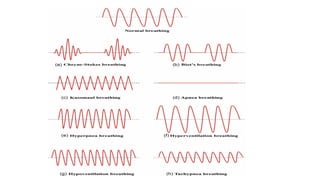 Respirataory physiology periodic breathing-1.pptx