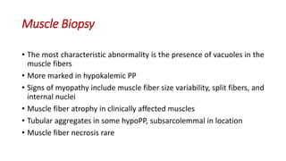 Muscle Biopsy
• The most characteristic abnormality is the presence of vacuoles in the
muscle fibers
• More marked in hypokalemic PP
• Signs of myopathy include muscle fiber size variability, split fibers, and
internal nuclei
• Muscle fiber atrophy in clinically affected muscles
• Tubular aggregates in some hypoPP, subsarcolemmal in location
• Muscle fiber necrosis rare
 