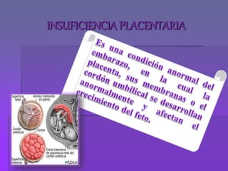 INSUFICIENCIAPLACENTARIA
 