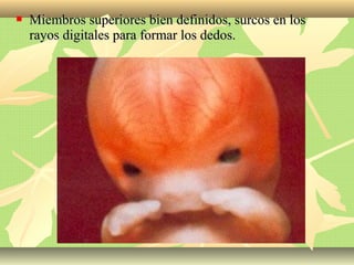  Miembros superiores bien definidos, surcos en losMiembros superiores bien definidos, surcos en los
rayos digitales para formar los dedos.rayos digitales para formar los dedos.
 
