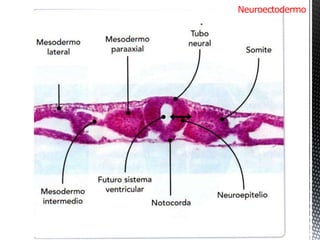 Neuroectodermo Periodo embrionario-etapa somítica-organogénesis. Dr. Igor Pardo Zapata ...