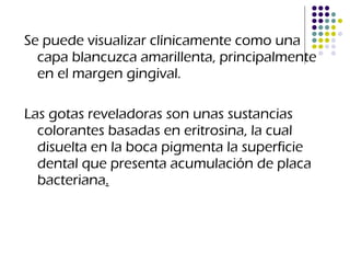 Se puede visualizar clínicamente como una capa blancuzca amarillenta, principalmente en el margen gingival. Las gotas reveladoras son unas sustancias colorantes basadas en eritrosina, la cual disuelta en la boca pigmenta la superficie dental que presenta acumulación de placa bacteriana . 