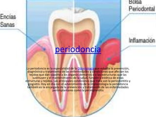 periodoncia
La periodoncia es la especialidad de la Odontología que estudia la prevención,
diagnóstico y tratamiento de las enfermedades y condiciones que afectan los
tejidos que dan soporte a los órganos dentarios o a las estructuras que las
sustituyen y el mantenimiento de la salud, función y estética de estas
estructuras y tejidos. Las principales condiciones que trata son la periodontitis y
gingivitis. Hoy en día con el advenimiento de la implantologia la periodoncia
también es la encargada de la prevención y tratamiento de las enfermedades
periimplantares como la perimplantitis
 