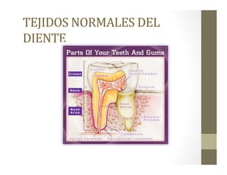 TEJIDOS	
  NORMALES	
  DEL	
  
DIENTE	
  
 