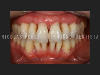 N I C O L A S P E R E Z - C I R U J A N O D E N T I S T A
 