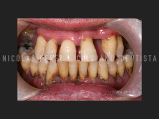 N I C O L A S P E R E Z - C I R U J A N O D E N T I S T A
 