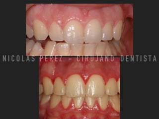 N I C O L A S P E R E Z - C I R U J A N O D E N T I S T A
 