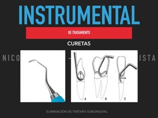INSTRUMENTALDE TRATAMIENTO
CURETAS
ELIMINACIÓN DE TÁRTARO SUBGINGIVAL
N I C O L A S P E R E Z - C I R U J A N O D E N T I S T A
 