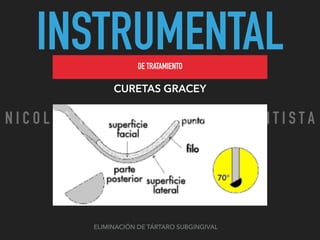 INSTRUMENTALDE TRATAMIENTO
CURETAS GRACEY
ELIMINACIÓN DE TÁRTARO SUBGINGIVAL
N I C O L A S P E R E Z - C I R U J A N O D E N T I S T A
 