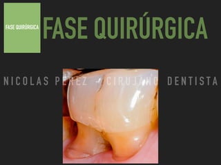 FASE QUIRÚRGICA
FASE QUIRÚRGICA
N I C O L A S P E R E Z - C I R U J A N O D E N T I S T A
 