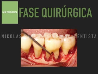FASE QUIRÚRGICA
FASE QUIRÚRGICA
N I C O L A S P E R E Z - C I R U J A N O D E N T I S T A
 