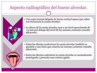 Aspecto radiográfico del hueso alveolar.
• Una capa normal delgada de hueso cortical opaco que cubre
con frecuencia la cresta alveolar.
• La altura de la cresta alveolar yace a un nivel aproximado de
1.5 mm por debajo del nivel de las uniones cemento-esmalte
adyacente.
• Entre los dientes posteriores la cresta alveolar también es
paralela a una línea que conecta las uniones cemento-esmalte
adyacente.
• Entre los dientes anteriores la cresta alveolar es normalmente
puntiaguda y presenta una corteza aguda.
 