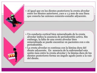 • Al igual que en los dientes posteriores la cresta alveolar
entre los dientes anteriores, yace a 1.5 mm de una línea
que conecta las uniones cemento-esmalte adyacente.
• Un conducto cortical bien mineralizado de la cresta
alveolar indica la ausencia de periodontitis activa. Sin
embargo, la falta de una cresta alveolar bien
mineralizada se puede encontrar en pacientes con o sin
periodontitis.
• La cresta alveolar es continua con la lámina dura del
diente adyacente. En ausencia de la enfermedad esta
unión ósea entre la cresta alveolar y la lámina dura de los
dientes posteriores forma un ángulo agudo junto a la raíz
del diente.
 