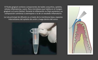 El fluido gingival contiene componentes de tejido conjuntivo, epitelio,
células inflamatorias, suero, flora microbiana que habita en el margen
gingival o el surco (bolsa). Durante la inflamación su flujo aumenta y su
composición comienza a asemejarse a la de un exudado inflamatorio.
La ruta principal de difusión es a través de la membrana basa, espacios
intercelulares del epitelio de unión y luego dentro del surco.
 