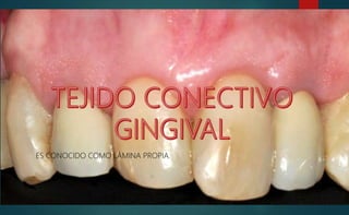 ES CONOCIDO COMO LÁMINA PROPIA.
 