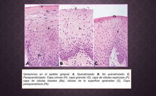Variaciones en el epitelio gingival. A, Queratinizado. B, No queratinizado. C,
Paraqueratinizado. Capa córnea (H), capa granular (G), capa de células espinosas (P),
capa de células basales (Ba), células de la superficie aplanadas (S), Capa
paraqueratósica (Pk)
A B C
 
