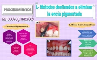 Después de la
hemostasia,
se coloca
apósito
periodontal
extirpar el
epitelio
pigmentado
junto con una
capa de tejido
conectivo
subyacente
Es simple,
fácil de
realizar,
económica
Está
contraindicado en
áreas gingivales
delgadas, donde
se puede conducir
a la recesión
gingival.
a. Técnica quirúrgica con bisturí
b. Método de abrasión con fresas
Bajo irrigación
abundante, se debe
aplicar una presión
mínima y ligera como
un suave cepillado
Es simple,
fácil de
realizar,
rentable
suele ser difícil
de controlar la
profundidad
del desgaste
a
b
 