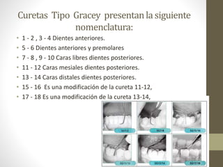 Curetas Tipo Gracey presentanla siguiente
nomenclatura:
• 1 - 2 , 3 - 4 Dientes anteriores.
• 5 - 6 Dientes anteriores y premolares
• 7 - 8 , 9 - 10 Caras libres dientes posteriores.
• 11 - 12 Caras mesiales dientes posteriores.
• 13 - 14 Caras distales dientes posteriores.
• 15 - 16 Es una modificación de la cureta 11-12,
• 17 - 18 Es una modificación de la cureta 13-14,
 