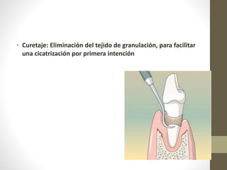 • Curetaje: Eliminación del tejido de granulación, para facilitar
una cicatrización por primera intención
 