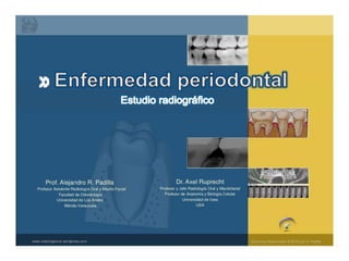 Estudio Radiográfico De La Enfermedad Periodontal