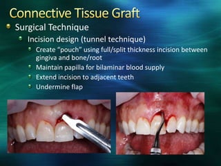 Periodontal plastic surgery | PPTX