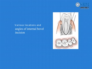 PERIODONTAL.pdf. Perio.flap.surgery.periodontics | PDF
