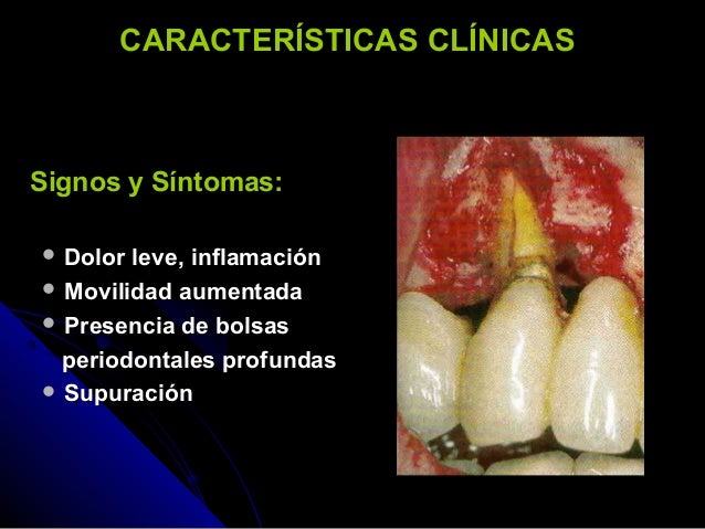 Enfermedad periodontal y diabetes Enfermedad periodontal y diabetes