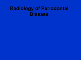 Radiology of Periodontal
Disease
 