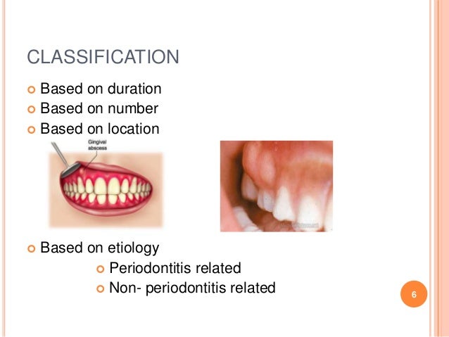 Periodontal abscess