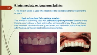 Permanent Splints periodontal consideration.pptx