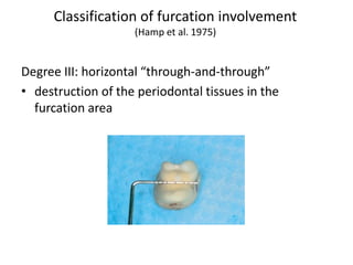 Hamp Classification PERIODONTAL DIAGNOSIS AND SCREENING 18.4.19.pdf