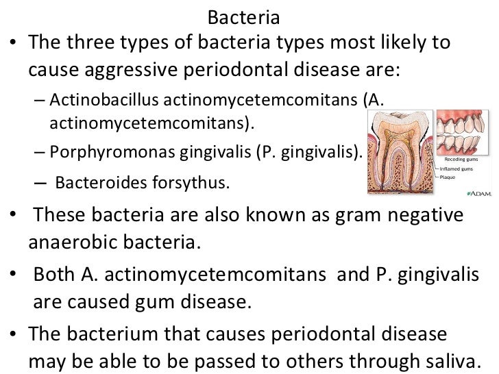 Periodontal disease