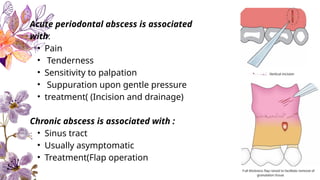 periodontal disease.ppt periodontal pocket | PPTX