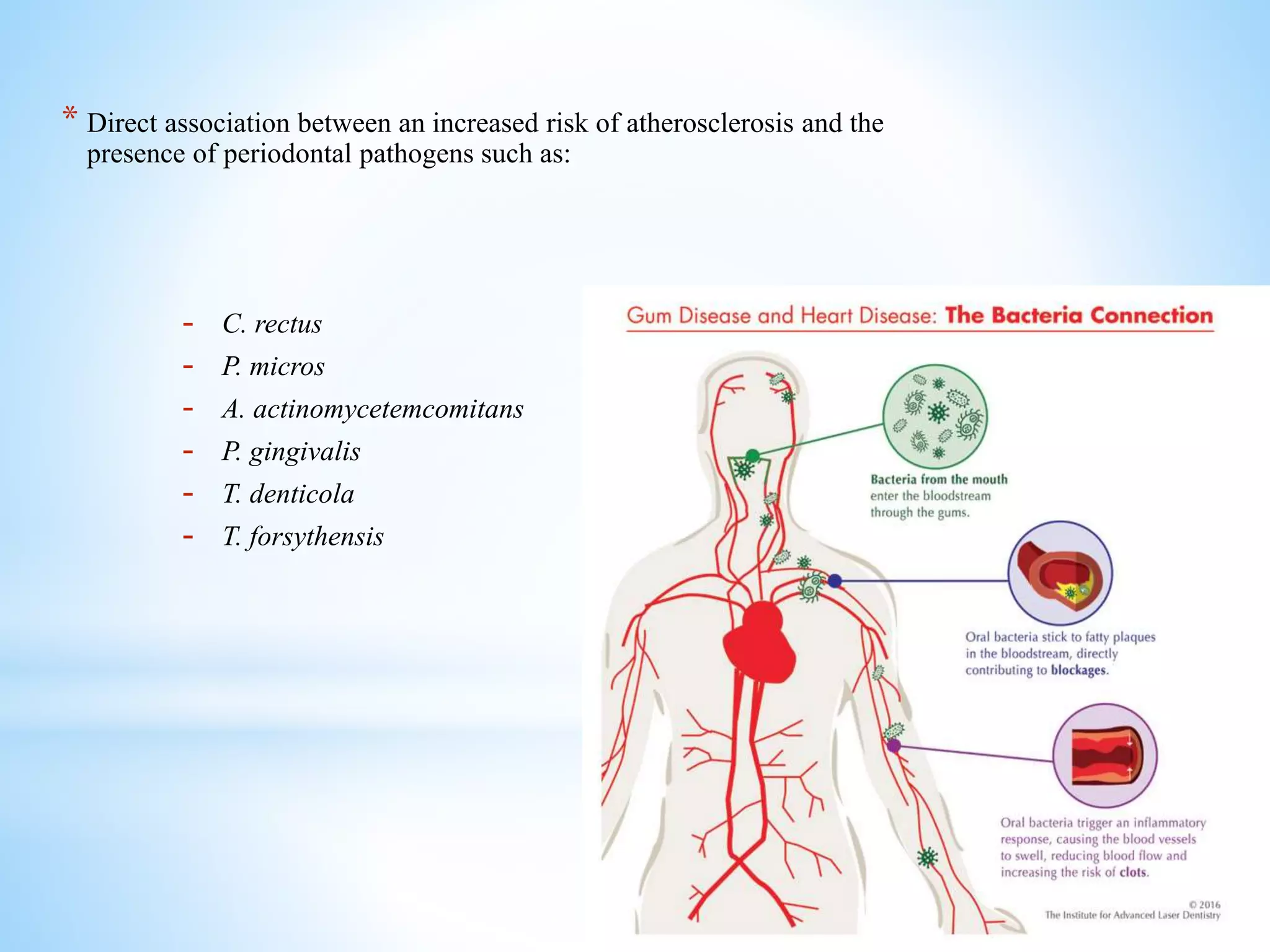 Periodontal disease and cardio vascular disease shree | PPTX
