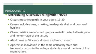 PERIODONTITIS
 Necrotizing Ulcerative Gingivitis (NUG)
 Occurs most frequently in your adults 16-30
 Causes include stress, smoking, inadequate diet, and poor oral
hygiene
 Characteristics are inflamed gingiva, metallic taste, halitosis, pain,
and hemorrhage of the tissues
 Also knows as Vincent's disease and trench mouth
 Appears in individuals in the same unhealthy state and
frequently occurs in the college students around the time of final
examinations
 