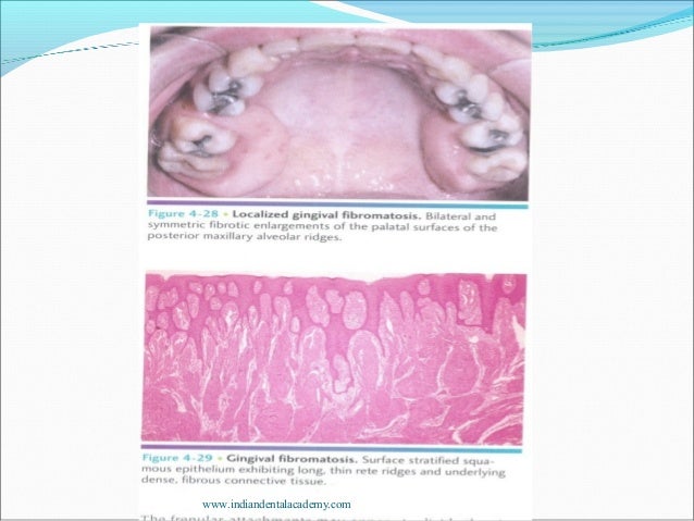 Periodontal Diseases Ii New Endodontic Courses