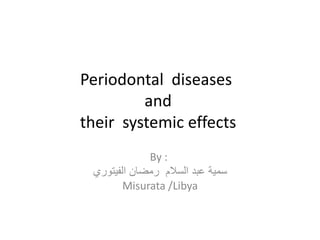 Periodontal diseases
and
their systemic effects
By :
‫السالم‬ ‫عبد‬ ‫سمية‬‫رمضان‬‫الفيتوري‬
Misurata /Libya
 