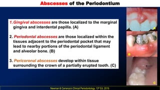 Eruption Abscess Periodontal diseases Classifications and treatments | PDF