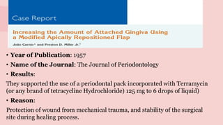 Increasing the Amount of Attached Gingiva Using
a Modified Apically Repositioned Flap
• Year of Publication: 1957
• Name of the Journal: The Journal of Periodontology
• Results:
They supported the use of a periodontal pack incorporated with Terramycin
(or any brand of tetracycline Hydrochloride) 125 mg to 6 drops of liquid)
• Reason:
Protection of wound from mechanical trauma, and stability of the surgical
site during healing process.
 