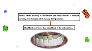 Surface of the dressings is smoothened and excess material is removed
ensuring non displacement of dressing during function.
Should not cover more than apical third of the tooth surface.
 