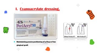 I. Cyanoacrylate dressing,
⚫ Maintaining precise positioning of a flap or free
gingival graft
 