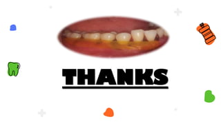 THANKS
 