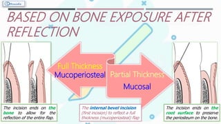 BASED ON BONE EXPOSURE AFTER
REFLECTION
Full Thickness
Mucoperiosteal Partial Thickness
Mucosal
The internal bevel incision
(first incision) to reflect a full
thickness (mucoperiosteal) flap
The incision ends on the
root surface to preserve
the periosteum on the bone.
The incision ends on the
bone to allow for the
reflection of the entire flap.
 