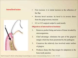 Periodontal flaps | PPT