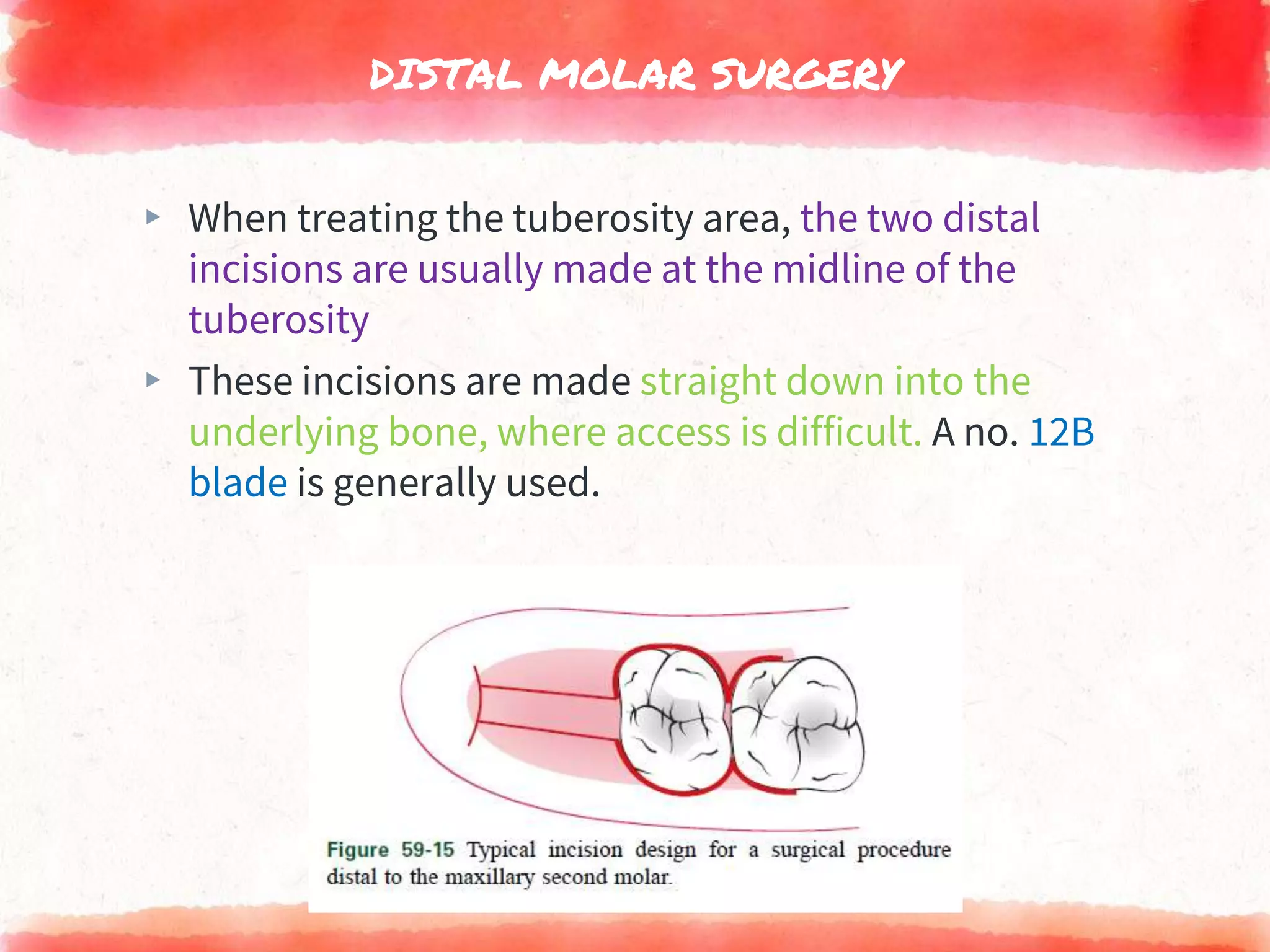 Periodontal flap surgery | PPTX