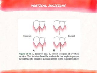 VERTICAL INCISIONS
 