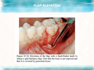 FLAP ELEVATION
 