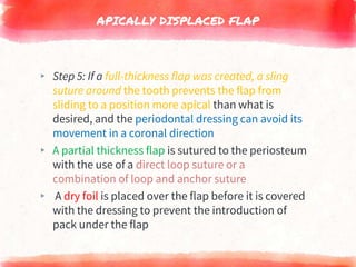 APICALLY DISPLACED FLAP
▸ Step 5: If a full-thickness flap was created, a sling
suture around the tooth prevents the flap from
sliding to a position more apical than what is
desired, and the periodontal dressing can avoid its
movement in a coronal direction
▸ A partial thickness flap is sutured to the periosteum
with the use of a direct loop suture or a
combination of loop and anchor suture
▸ A dry foil is placed over the flap before it is covered
with the dressing to prevent the introduction of
pack under the flap
 