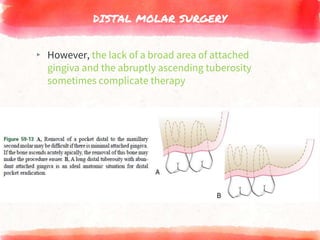 DISTAL MOLAR SURGERY
▸ However, the lack of a broad area of attached
gingiva and the abruptly ascending tuberosity
sometimes complicate therapy
 