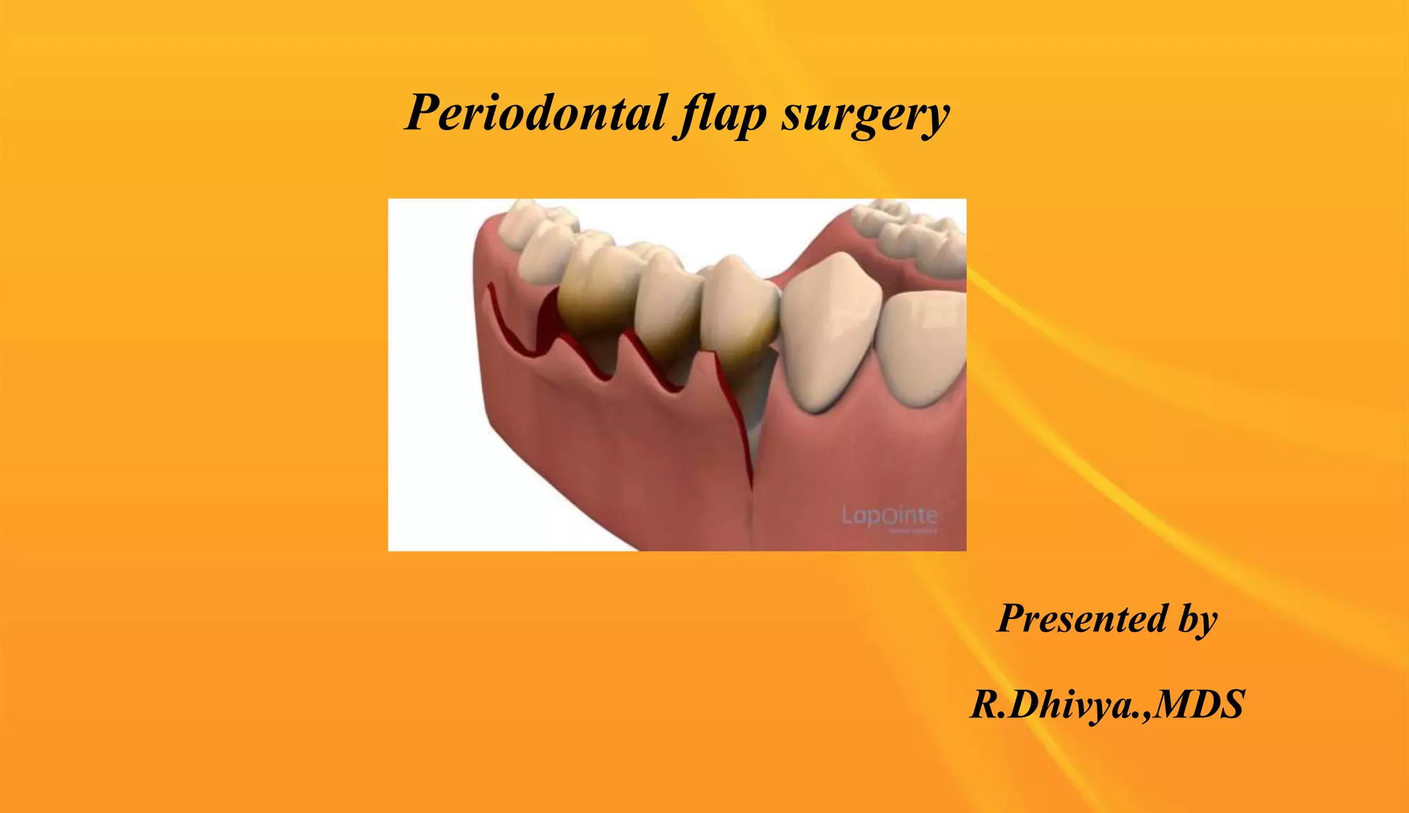 Periodontal flap surgery | PPTX